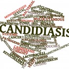 Do You Have Candida?